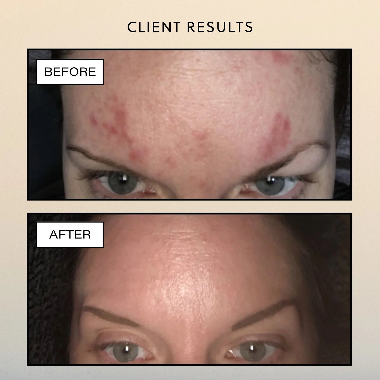 Botanical Recovery Serum